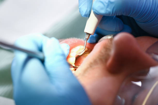 Best Emergency Dentist for Knocked-Out Tooth in Batesville, MS